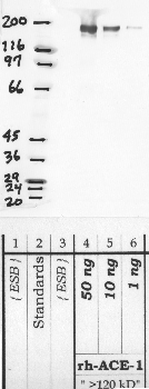 Anti-ACE Rabbit Polyclonal Antibody