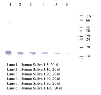 Anti-CST2 Rabbit Polyclonal Antibody