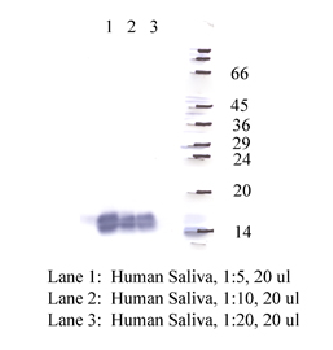 Anti-CSTD Rabbit Polyclonal Antibody