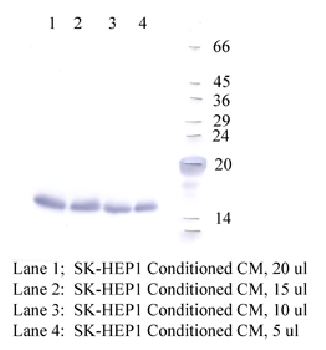 Anti-CSTC Rabbit Polyclonal Antibody
