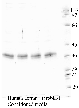 Anti-CTSK Rabbit Polyclonal Antibody