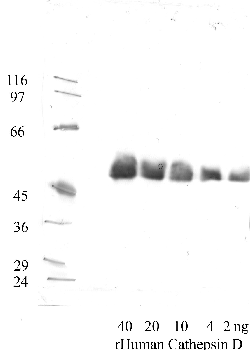 Anti-CTSD Rabbit Polyclonal Antibody