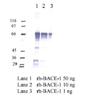 Anti-BACE1 Rabbit Polyclonal Antibody