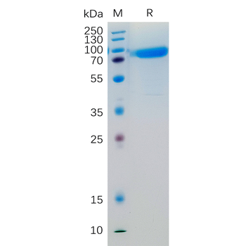 Human DDR1 Protein, His Tag