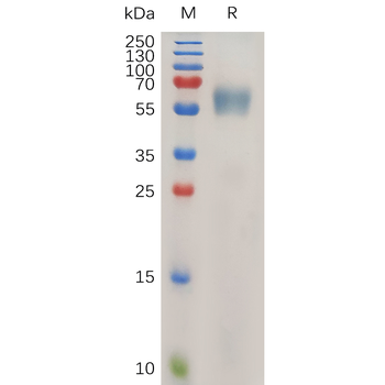 Human GPC1 Protein, His Tag