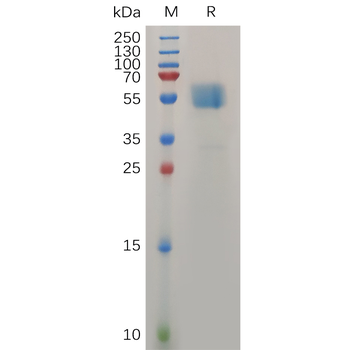 Human IL1A Protein, hFc Tag