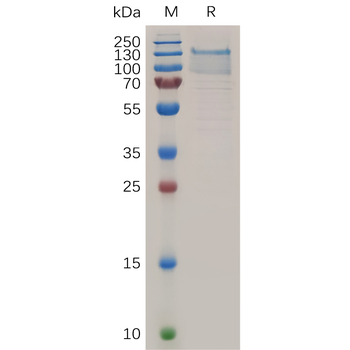 Human B7-H5 Protein, hFc Tag