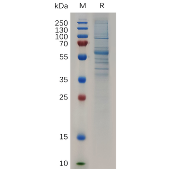Human SIGLEC9 Protein, His Tag