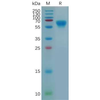 Human GDNF Protein, hFc Tag