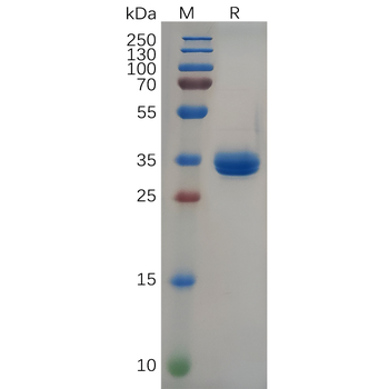 Human IL7RA Protein, hFc Tag