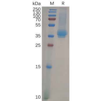 Human CXCR4 Protein, hFc Tag