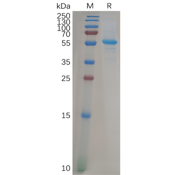 Human CEACAM1 Protein,His Tag
