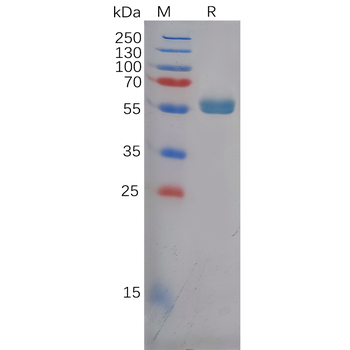 Human GPA33 Protein, hFc Tag