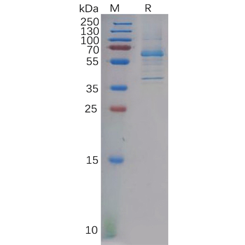 Human CDH17 Protein, His Tag