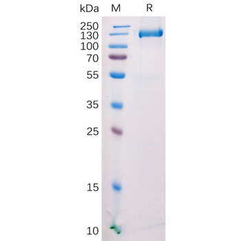 SARS-CoV-2 (Omicron) S protein RBD Protein