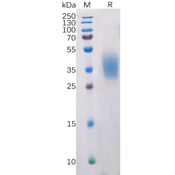 Human VWF (23-763) Protein, His Tag