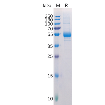 Human GFAP (7-66) Protein, hFc Tag