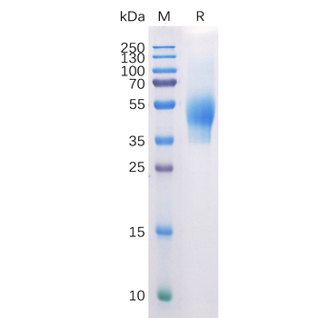 Human SLC2A4 Protein, hFc Tag