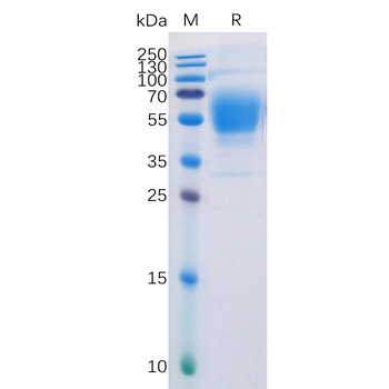 SARS-CoV-2 (Delta) S protein RBD , hFc Tag