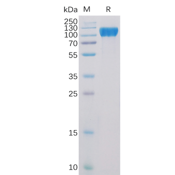 SARS-CoV-2 (Delta) Nucleocapsid, C-His Tag