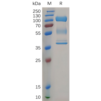 SARS-CoV-2 (Delta) S protein RBD, His Tag