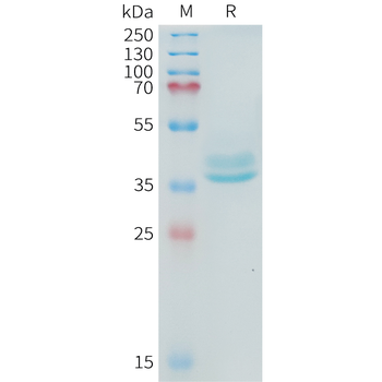 Human CD23 Protein, His Tag