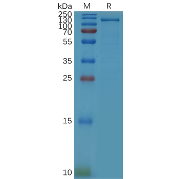 Human IL11 Protein, hFc Tag