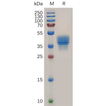 Human EPHB2 Protein, His Tag