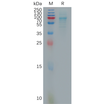 Human IL17C Protein, hFc Tag