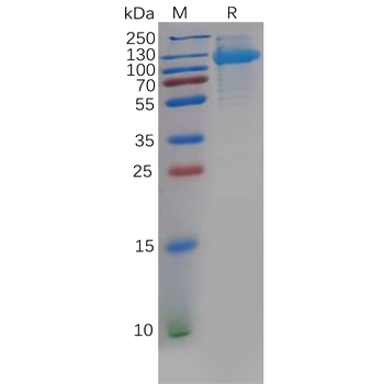Human CD69 Protein, hFc Tag