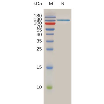 Human FGFR4 Protein, His Tag