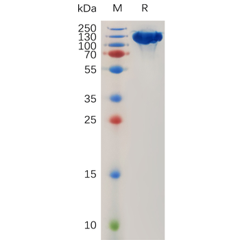 Human CD26 (29-766) Protein, His Tag