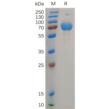 Human M-CSF Protein, mFc Tag