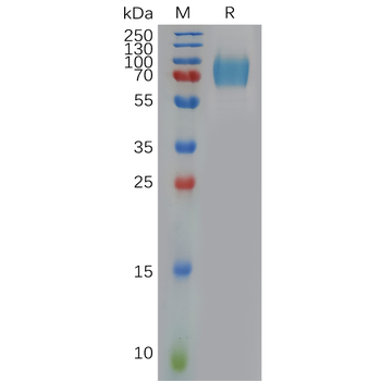 Human GM-CSF Protein, hFc Tag