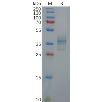 Mouse GPRC5D Protein, hFc Tag