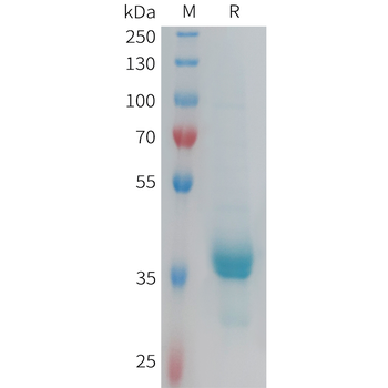 Human IL4RA Protein, mFc Tag