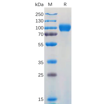 Human M-CSF Protein, hFc Tag