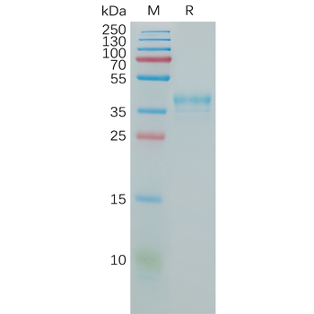 Human IL15RA Protein, hFc Tag