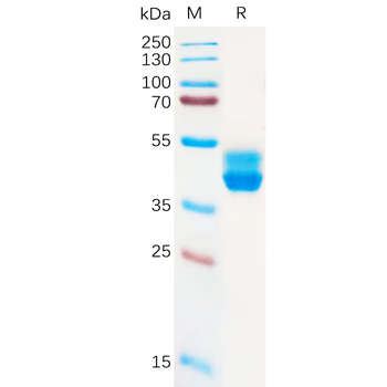 SARS-CoV-2 (Alpha) S protein RBD , hFc Tag