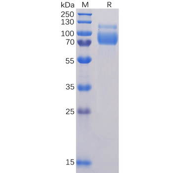 Human CD36 Protein, hFc Tag