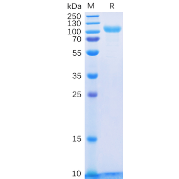 Human CCL20 Protein, hFc Tag