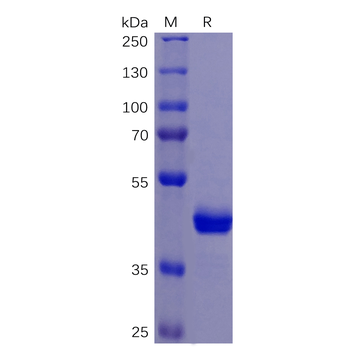 Human DLL3 Protein, His Tag