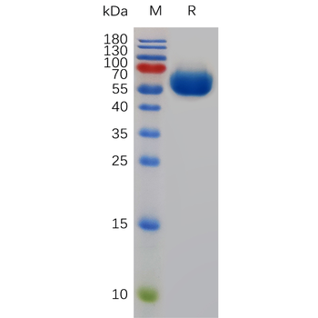 Human KLK3 Protein, His Tag