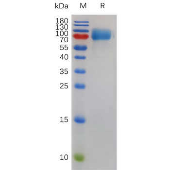 Human SEMA4D Protein, His Tag