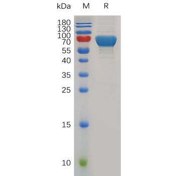 Human BST2 Protein, hFc Tag
