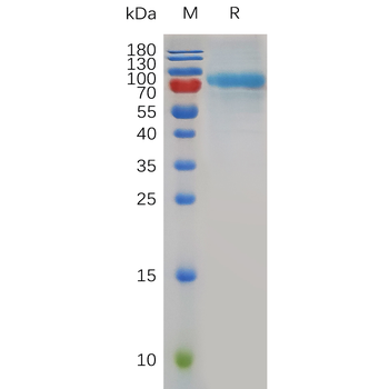 Human SCG3 Protein, His Tag