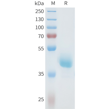 Mouse IL2RA Protein, hFc Tag