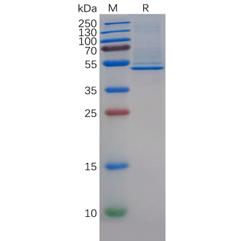 Human IFNA1 Protein, hFc Tag