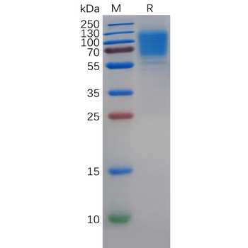 Human CD19 Protein, mFc Tag