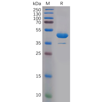 Human RSPO1(21-146) Protein, hFc Tag